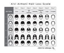 Load image into Gallery viewer, Laser (not LED) helmet 64 /68medical diodes for hair regrowth
